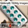 Sildenafil 100Mg Images dapoxetine1